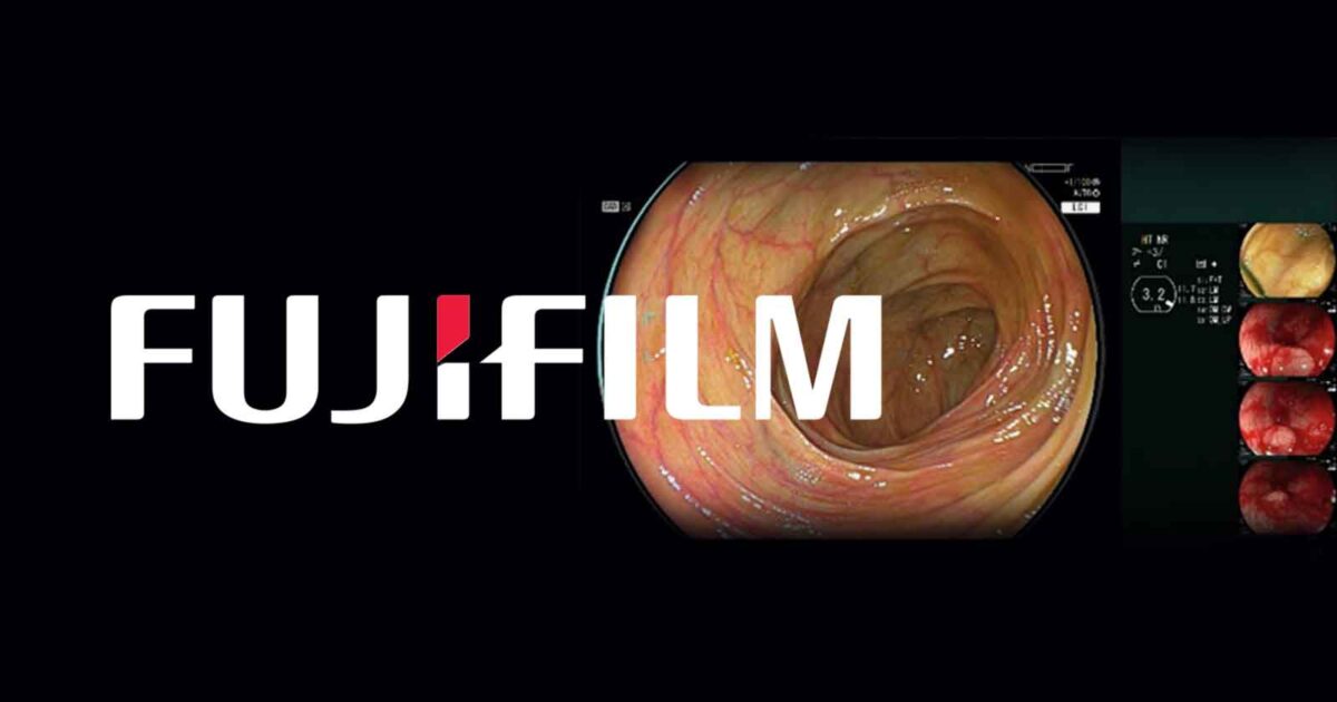 Fujifilm's AI-Powered Endoscopy System Receives FDA Approval